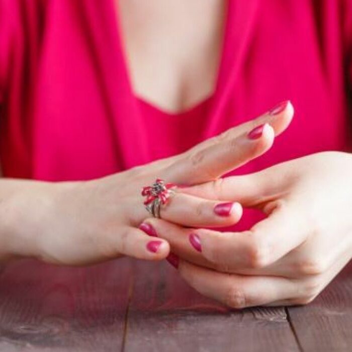 Ring Rips Off Finger Wedding ring pulls skin off finger | Beachweddingtips.com